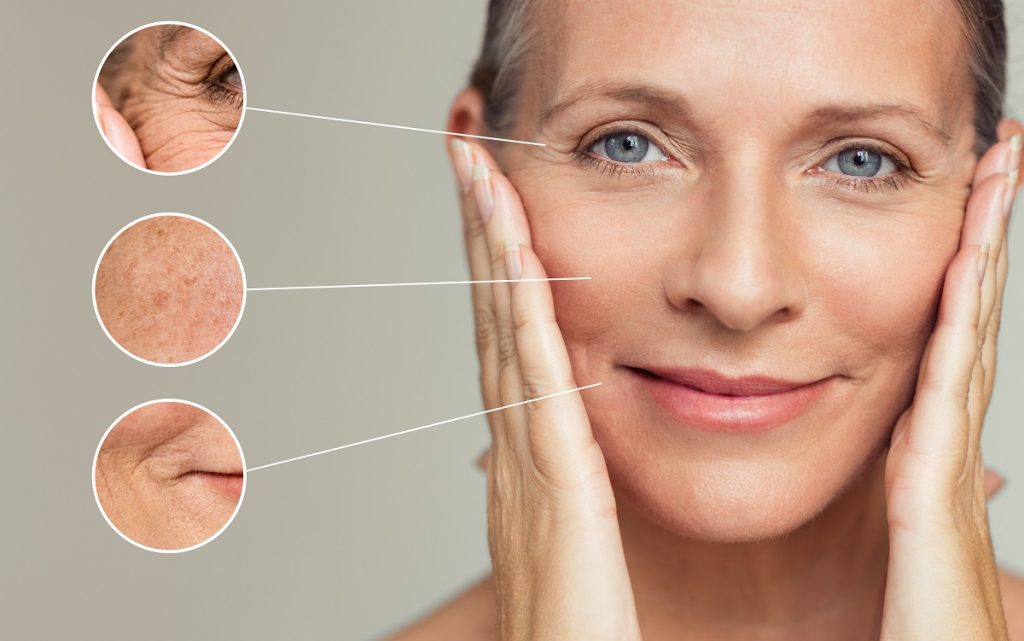 Problem spots on aging skin